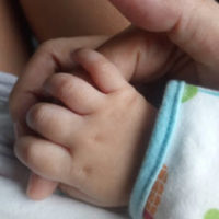 BirthInj_babyHand